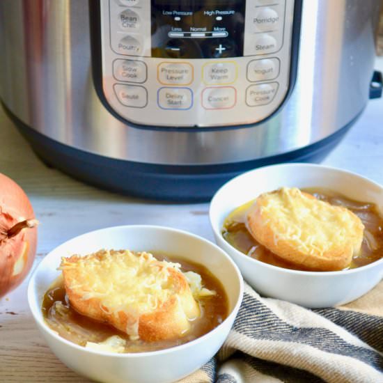 Instant Pot French Onion Soup
